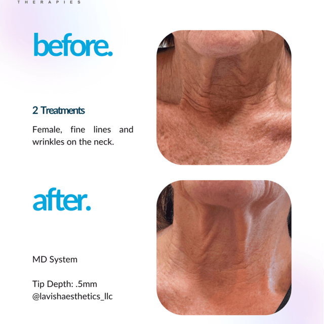 JULY PROCELLL SPECIAL at Skin Deep Esthetics in Columbus, MS